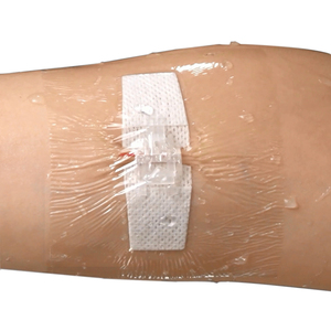 Sterile Waterproof Bacteria Resistant Hypoallergenic Adhesive Zipper Stitch Suture Strips